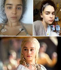 In 2011, just after she had finished filming the first season of “Game of  Thrones,” actress Emilia Clarke suffered the first of two life-threatening  strokes.