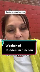 Duodenumfail