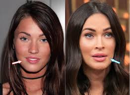 She is one of the most beautiful faces of show business who starred in the famous film transformers. Has Megan Fox Had Cosmetic Surgery Plasticsurgerypro Info