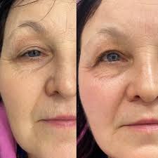 Euphoriastyle Villa Adriana