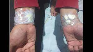 Cara mengobati sakit gigi dengan bawang putih, yakni sebagai berikut: Viral Bawang Putih Ditempel Di Tangan Obati Sakit Gigi Ini Kata Dokter