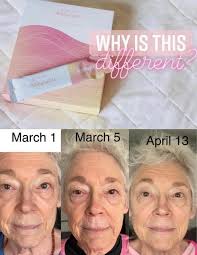 Sugar-free fish collagen jelly benefits