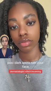 Comment “DARK SPOTS” and I will DM you links to these  dermatologist-approved products to fade dark spots & hyperpigmentation. ,  @lanacoreee you are stunning, #hyperpigmentation #darkspots ...