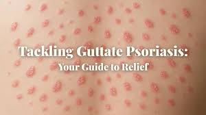 Image result for psoriasis