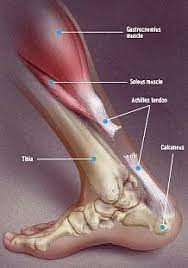Learn More About Achilles Tendon Rupture And How Eagle Summit Foot Ankle Can Repair This Sports Injury Sportsinjuries Menselijk Lichaam Lichaam Spieren