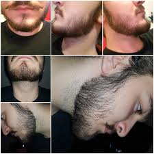Age also determines how thick your beard will be. Is My Beard To Thin And Patchy To Try And Grow It Out I M Only 17yo And This Is A 5 Week Beard Beards