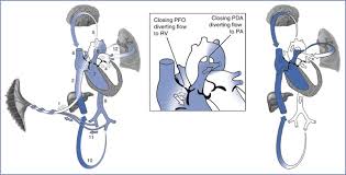 Image result for Neonatal Circulation Assessment