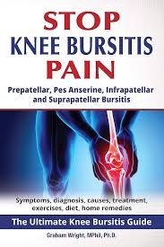 Image result for Prepatellar Bursitis