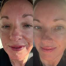 Deniz Akyol (@skinhealthbydeniz) · Jacksonville, FL · Instagram photos and  videos