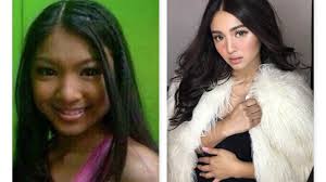 Long days under the sun can affect my skin but im glad the pond's online beauty james reid & nadine lustre (@jamesnadine_21116) | instagram photos and videos. Nadine Lustre Before And After Extreme Plastic Surgery Extreme Transformation Pinay Celebrity Youtube