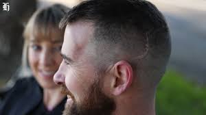 Lars Jacobsen almost lost his life last year after suffering a traumatic  brain injury