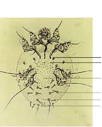 Image result for Sarcoptes scabiei