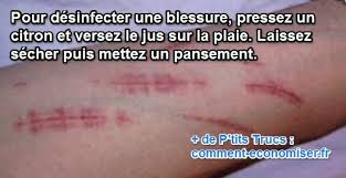 Epingle Sur Remedes Naturels
