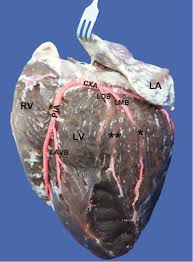What are the numbers of diagonals of a polygon having 12 sides? Characterisation Of Myocardial Bridges In Pigs A Comparative Anatomical Analysis With The Human Heart Gomez Folia Morphologica