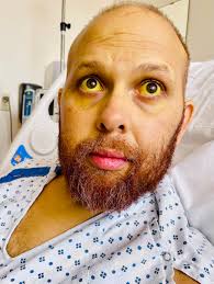 You may not be able to see our big smiles behind the masks, but yesterday  my husband (my donor!) and I celebrated our 3 month liver-versary! We are  not local to Cleveland,