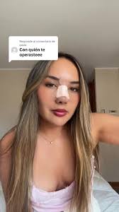 Experiencia en Rinoseptoplastia con Dr. Pablo Miranda