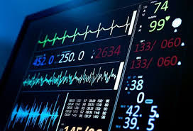 The ekg showed i had a heart attack sometime in the past. Electrocardiogram Ekg Ecg Test Results Interpretation