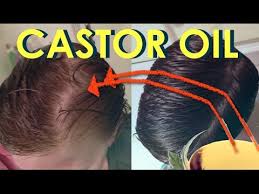 This type of hair loss is characterized by unusual hairline recession due to unusually tight pulling on the hair follicles, usually from overly tight ponytails or braiding. How To Stop A Receding Hairline Quickly The Trend Spotter