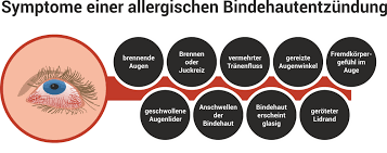 Infektiöse konjunktivitis wird am häufigsten durch ein virus verursacht. Allergische Bindehautentzundung Hilfe Bei Juckreiz Brennen Albert Schweitzer Apotheke Itzehoe