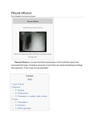 mesothelioma occurs more often in men. Pleural Effusion Hepatitis Cirrhosis