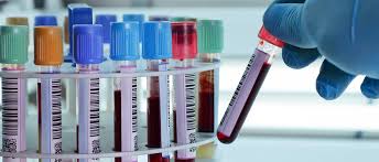 Roxana este unul dintre biologii din laboratorul central regina maria care procesează testele pcr pentru arn covid. Punct De Recoltare Lugoj