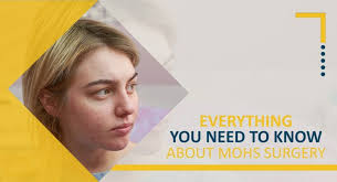 Everything You Need to Know About Mohs Surgery