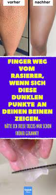 damit verschwinden die dunklen punkte auf den beinen rasieren dunkle flecken dunkelheit