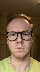 M20, Only getting worse. Should I do it? : r/bald