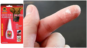 Check spelling or type a new query. 7 Cara Hilangkan Gam Gajah Super Glue Pada Tangan Kasut Baju Dan Plastik