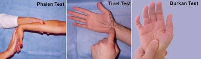 Image result for Carpal Compression Test