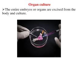 Pieces of tissues from the organ are removed aseptically; Introduction To Animal Tissue Culture Ppt Download