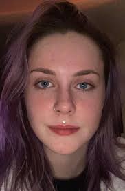 I've been debating a Medusa piercing for a while but have heard stories  about gum erosion, getting gaps in teeth and enamel wearing away. This is  how I'd look with one and