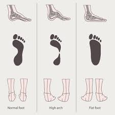 Relief for blocked hair follicles. Plantar Fasciitis Surgery Injury Causes Symptoms And Treatments