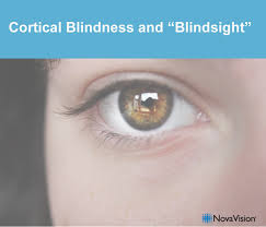 Thankfully, it's a condition that is totally preventable. Cortical Blindness And Blindsight Novavision