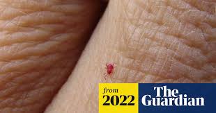 Image result for Trombicula autumnalis bites