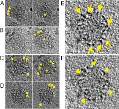 Суммарные антитела к вирусу вирус гепатита с, определение рнк кол. Ultrastructural Analysis Of Hepatitis C Virus Particles Pnas