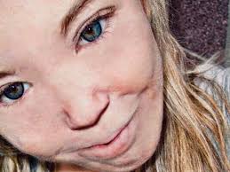 Fundraiser for Amber Peacock by Holly Hamilton : Amber's Battle with  Porphyria