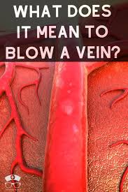 Pin On Phlebotomy Study