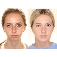 Arnett Gunson Facial...