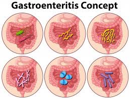 Most of the time, a virus is the culprit, in which case the illness is known as viral gastroenteritis. Free Vector Diagram Showing Gastroenteritis Concept Illustration