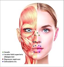Common Upper Face Injection Areas To Be Used Merely As
