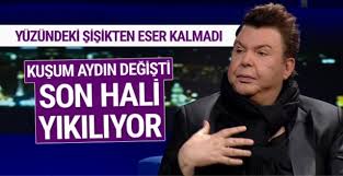 Sana Ne Oldu Aydin Gorenler Taniyamadi Son Hali Olay