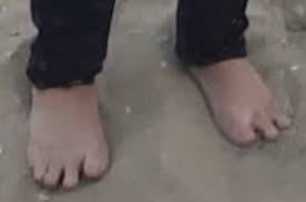 Maybe you would like to learn more about one of these? Pierre Joseph On Twitter Greene Marjorietraitorgreene The Cloven Hooves Of Marjorie Taylor Greene Https T Co Tkba7jjqqf Twitter