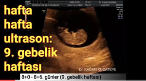 9 haftalik gebelik