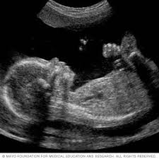 EcografÃ­a fetal - Mayo Clinic