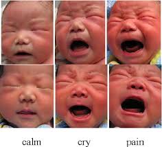 Figure 2 from Facial expression recognition for neonatal pain assessment