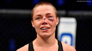 Latest on rose namajunas including news, stats, videos, highlights and more on espn. Espn Mma On Twitter Rose Namajunas Had Successful Nose Surgery Friday Her Team Told Arielhelwani Namajunas Nose Was Broken In The Third Round Of Her Eventual Split Decision Victory Over Jessica Andrade