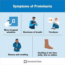 Image result for Isolated Proteinuria