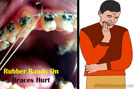 After the initial pain goes away, you can eat hard foods in thin slices or small pieces. Why Do Rubber Bands On Braces Hurt So Much Orthodontic Braces Care