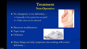 Image result for Hallux Varus